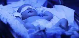 اجاره دستگاه زردی نوزاد