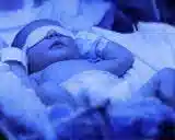 اجاره دستگاه زردی نوزاد