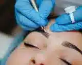 میکروبلیدینگ و میکروپیگمنتیشن