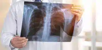 رادیولوژی در منزل