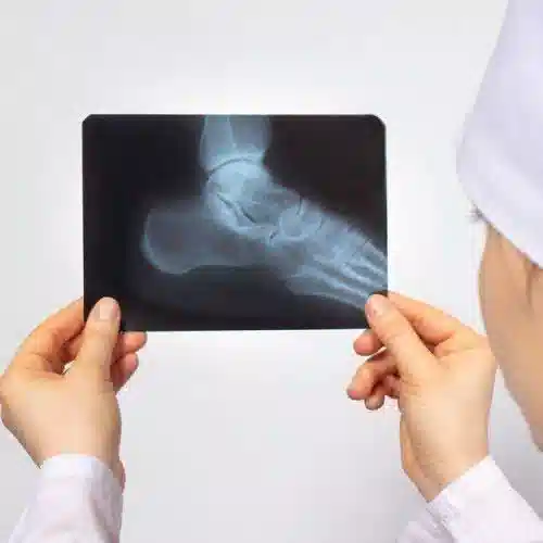 قیمت رادیولوژی در منزل