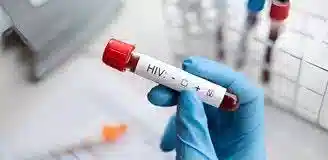 آزمایش ایدز در خانه