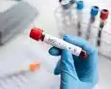 قیمت آزمایش ایدز در منزل