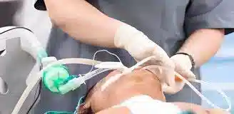 ساکشن بیمار در منزل