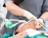 ساکشن در منزل