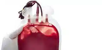 فصد خون در منزل