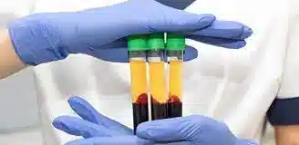 پی آر پی در منزل