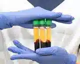 پی آر پی در منزل