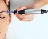 مزوتراپی در منزل